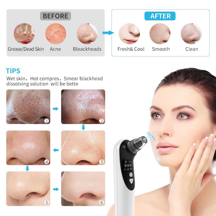 Blackhead Remover