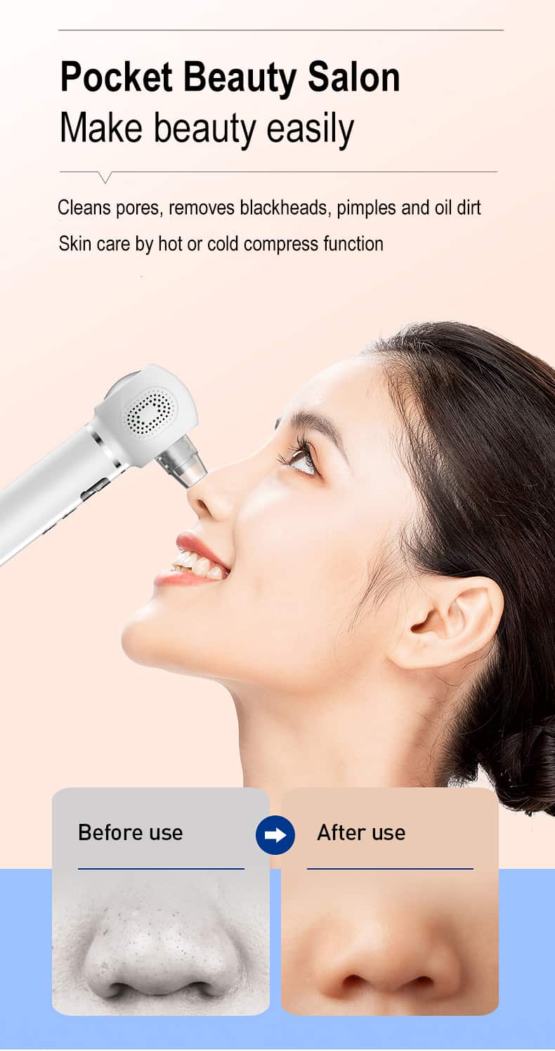 Blackhead Remover