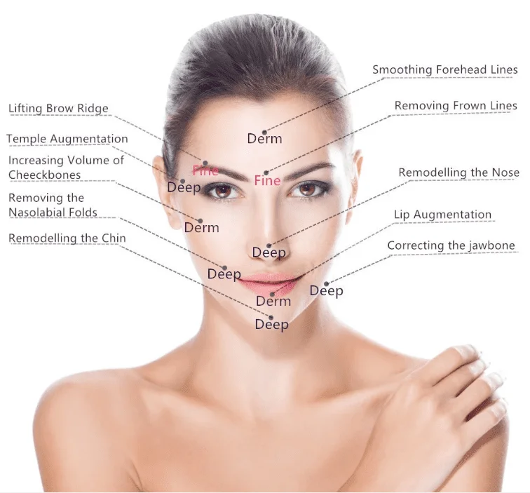 Emerry Hyaluronic Acid Fillers 20ml Derm Plus - Image 3