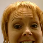 metox before